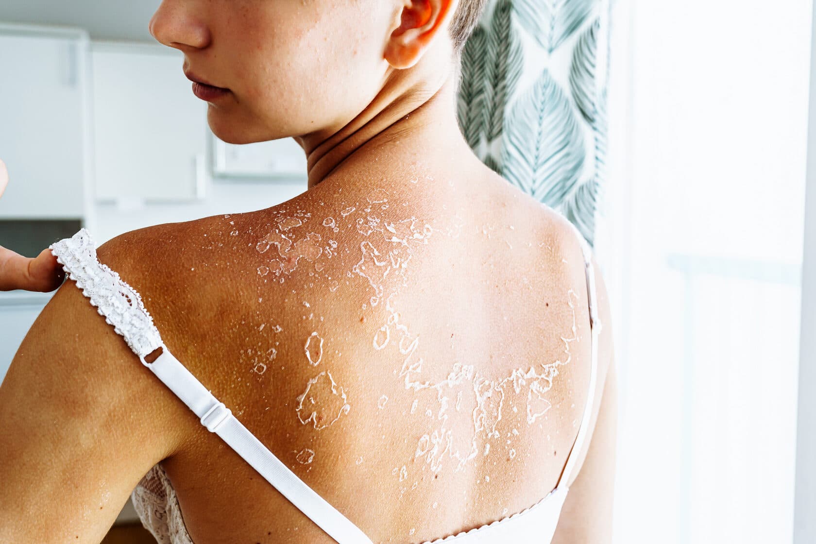 AHA Acids for Dry Body Skin - A Revolution in Skincare?